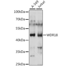 Western Blot - Anti-WDR18 Antibody (A90080) - Antibodies.com