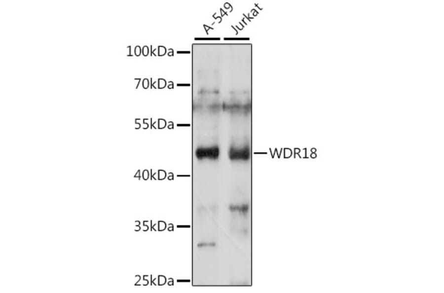 Western Blot - Anti-WDR18 Antibody (A90080) - Antibodies.com
