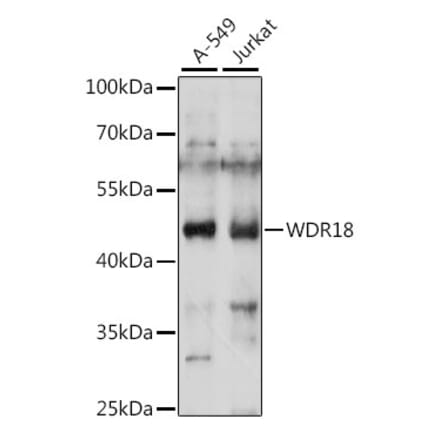 Western Blot - Anti-WDR18 Antibody (A90080) - Antibodies.com
