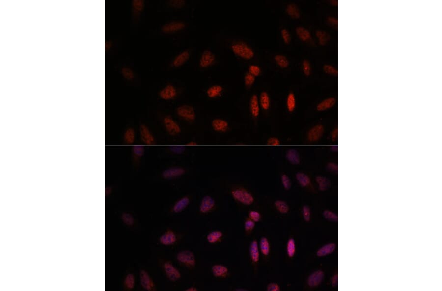 Immunofluorescence - Anti-WDR18 Antibody (A90080) - Antibodies.com