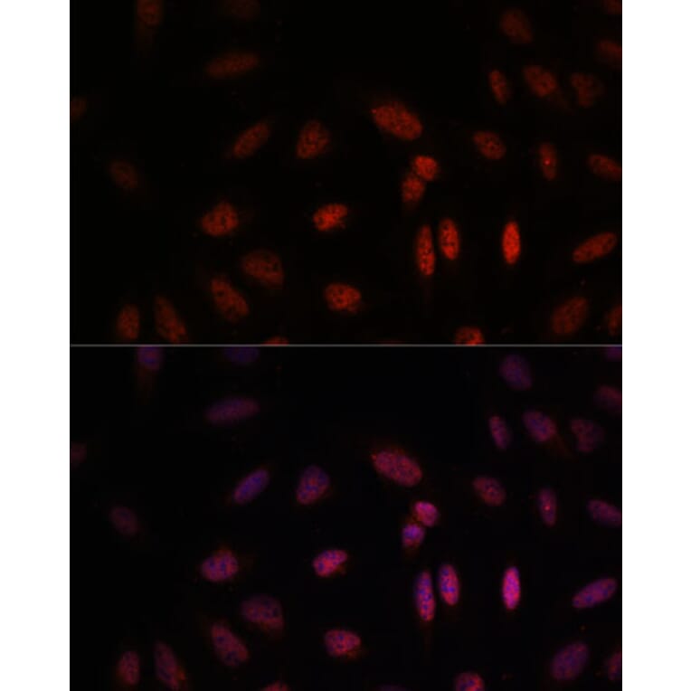 Immunofluorescence - Anti-WDR18 Antibody (A90080) - Antibodies.com