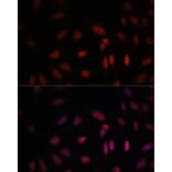 Immunofluorescence - Anti-WDR18 Antibody (A90080) - Antibodies.com