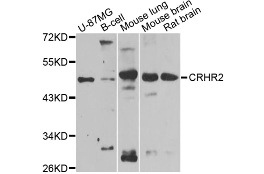 Western Blot - Anti-CRHR2 Antibody (A12428) - Antibodies.com