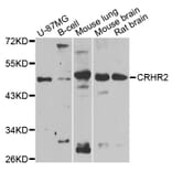 Western Blot - Anti-CRHR2 Antibody (A12428) - Antibodies.com