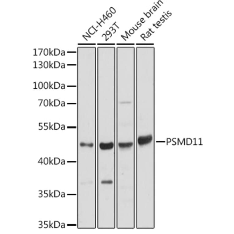 Western Blot - Anti-PSMD11 Antibody (A90082) - Antibodies.com