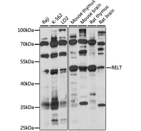 Western Blot - Anti-TNFRSF19L Antibody (A90083) - Antibodies.com