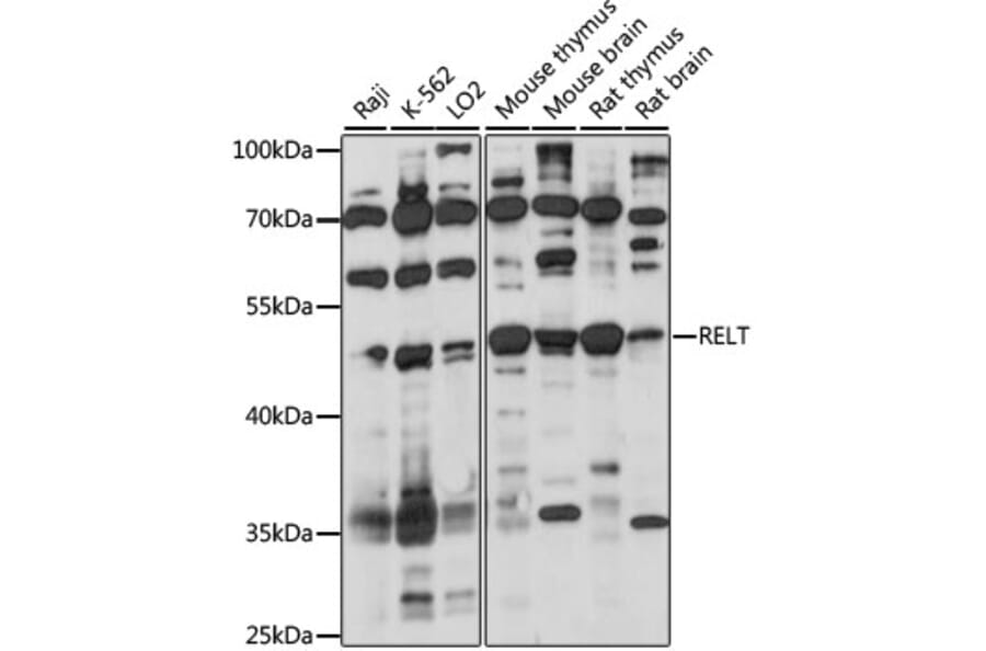 Western Blot - Anti-TNFRSF19L Antibody (A90083) - Antibodies.com