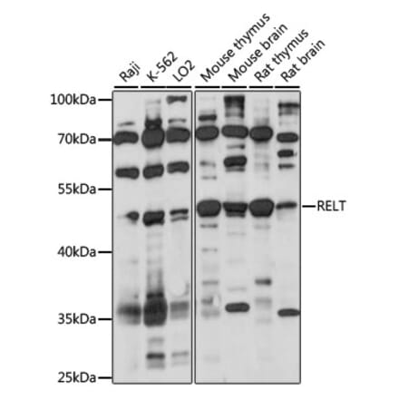 Western Blot - Anti-TNFRSF19L Antibody (A90083) - Antibodies.com