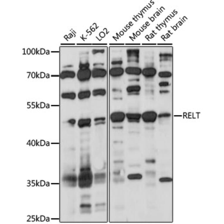 Western Blot - Anti-TNFRSF19L Antibody (A90083) - Antibodies.com