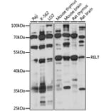 Western Blot - Anti-TNFRSF19L Antibody (A90083) - Antibodies.com