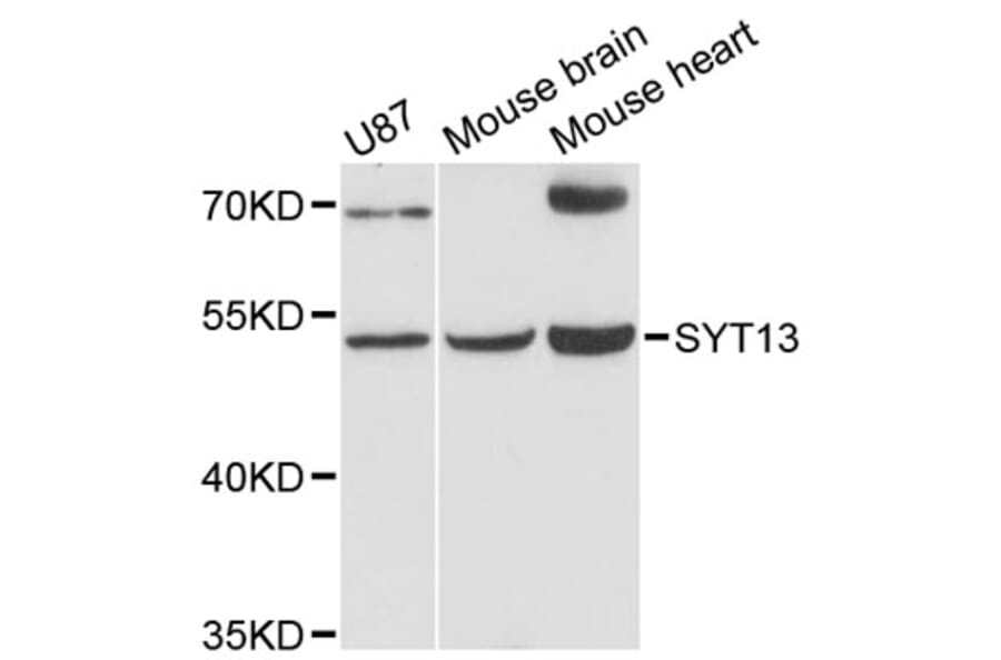 Western Blot - Anti-SYT13 Antibody (A12852) - Antibodies.com