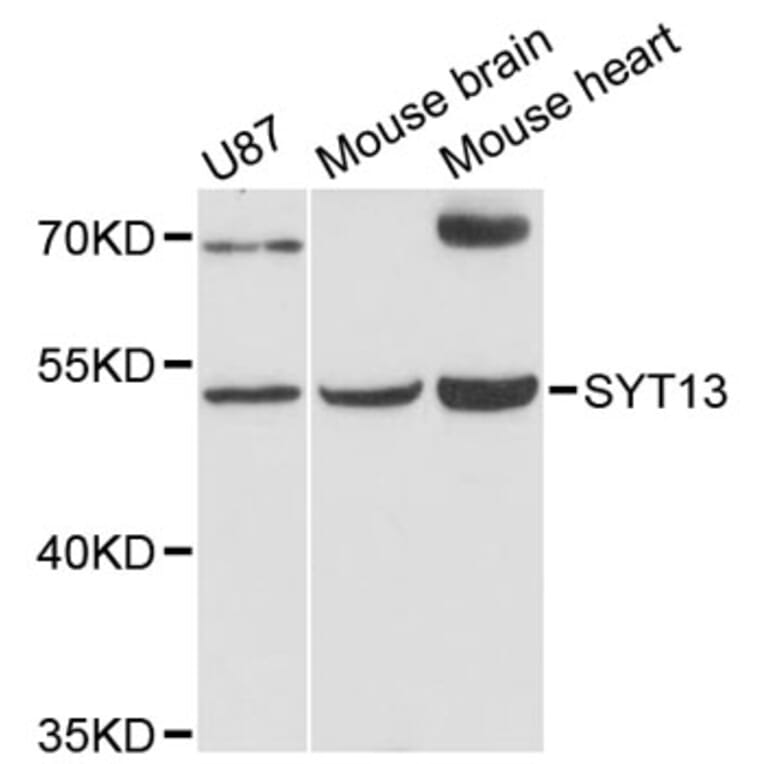 Western Blot - Anti-SYT13 Antibody (A12852) - Antibodies.com