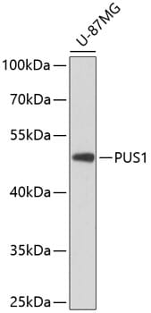 Western blot analysis of extracts of U-87MG cells, using Anti-PUS1 Antibody (A8720) at 1:3000 dilution.
Secondary antibody: Goat Anti-Rabbit IgG (H+L) (HRP) (AS014) at 1:10,000 dilution.
Lysates / proteins: 25µg per lane.
Blocking buffer: 3% non-fat dry milk in TBST.
Detection: ECL Basic Kit (RM00020).
Exposure time: 90s.