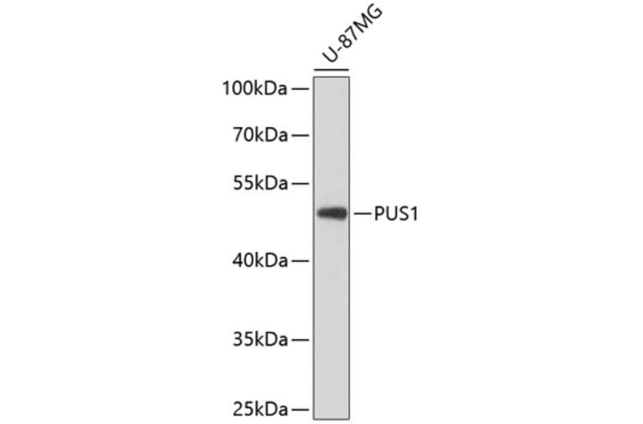 Western Blot - Anti-PUS1 Antibody (A90085) - Antibodies.com