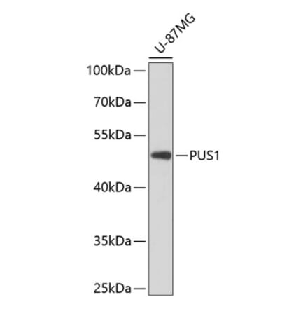 Western Blot - Anti-PUS1 Antibody (A90085) - Antibodies.com