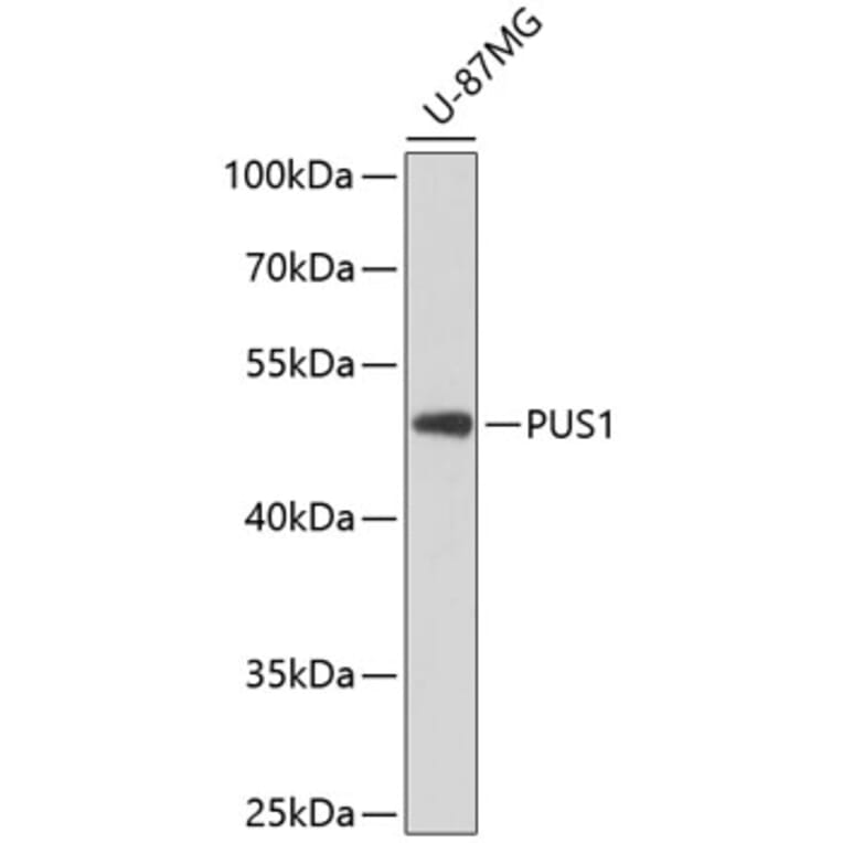 Western Blot - Anti-PUS1 Antibody (A90085) - Antibodies.com