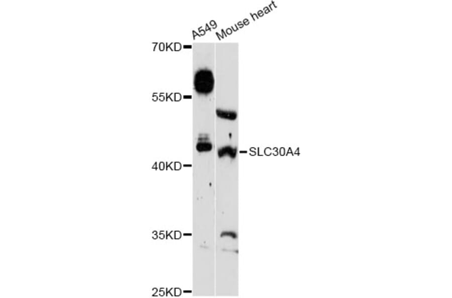 Western Blot - Anti-SLC30A4 Antibody (A13053) - Antibodies.com