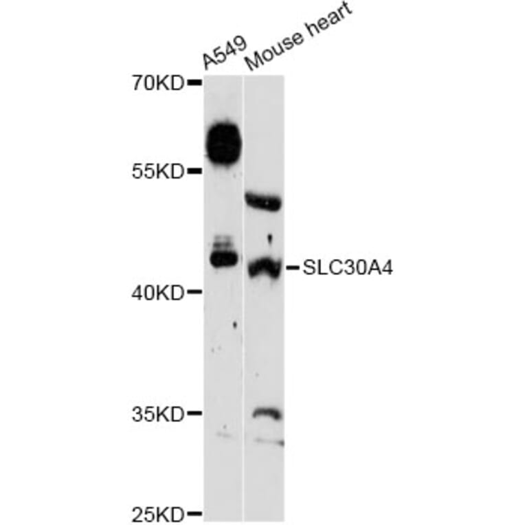 Western Blot - Anti-SLC30A4 Antibody (A13053) - Antibodies.com