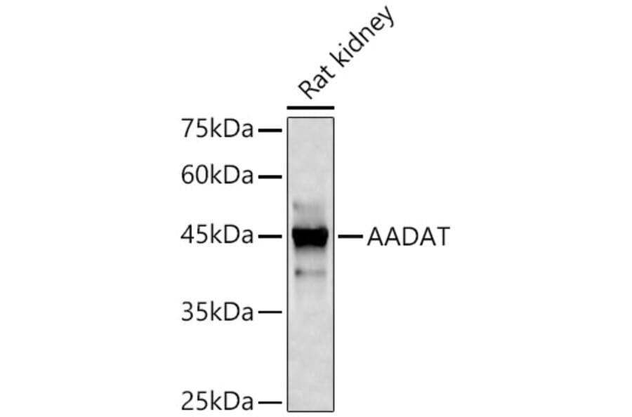Western Blot - Anti-KAT2/AadAT Antibody (A90087) - Antibodies.com