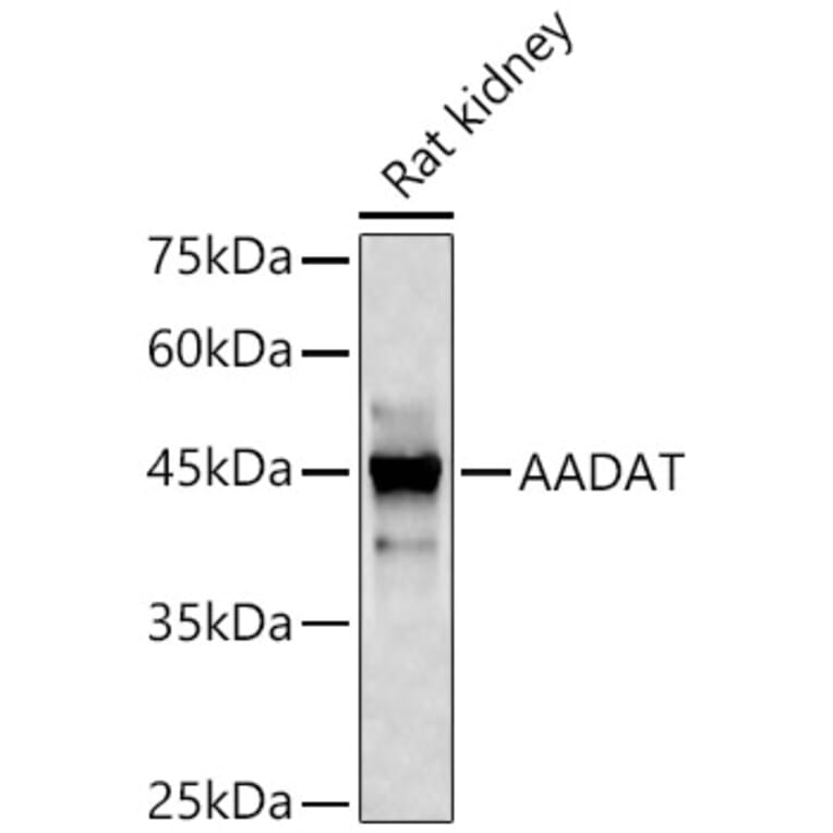 Western Blot - Anti-KAT2/AadAT Antibody (A90087) - Antibodies.com