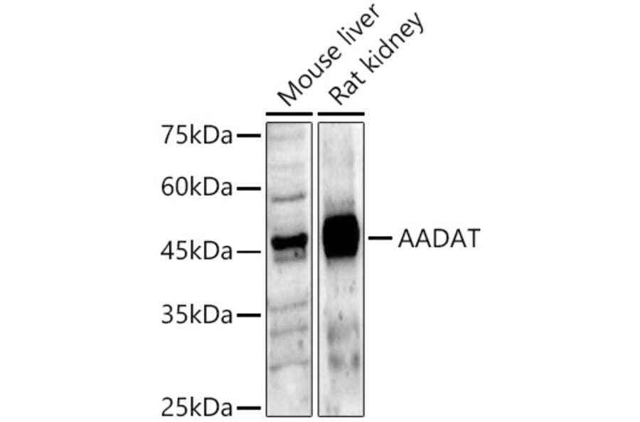 Western Blot - Anti-KAT2/AadAT Antibody (A90088) - Antibodies.com