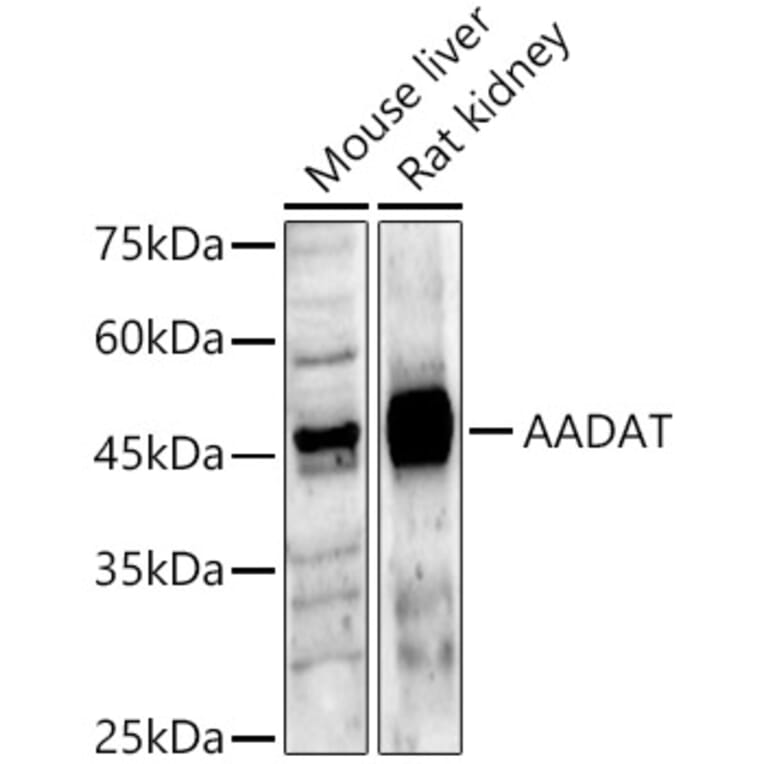 Western Blot - Anti-KAT2/AadAT Antibody (A90088) - Antibodies.com