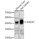 Western Blot - Anti-KAT2/AadAT Antibody (A90088) - Antibodies.com