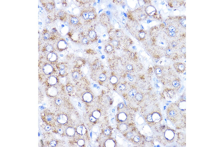 Immunohistochemistry - Anti-KAT2/AadAT Antibody (A90088) - Antibodies.com