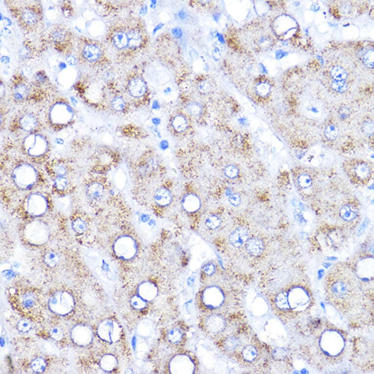 Immunohistochemistry - Anti-KAT2/AadAT Antibody (A90088) - Antibodies.com
