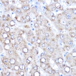 Immunohistochemistry - Anti-KAT2/AadAT Antibody (A90088) - Antibodies.com