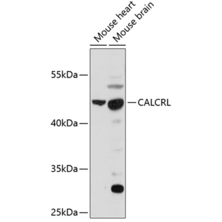 Western Blot - Anti-CRLR Antibody (A90090) - Antibodies.com