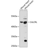 Western Blot - Anti-CRLR Antibody (A90090) - Antibodies.com