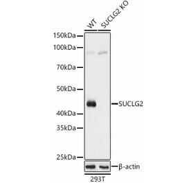 Western Blot - Anti-SUCLG2 Antibody (A90091) - Antibodies.com
