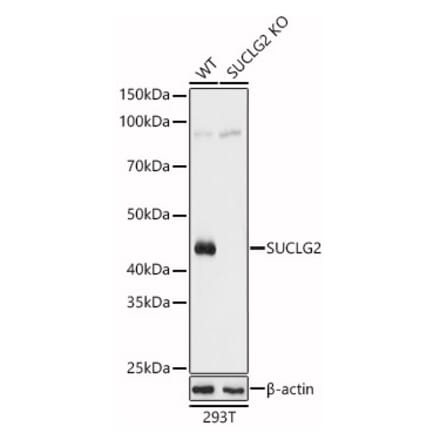 Western Blot - Anti-SUCLG2 Antibody (A90091) - Antibodies.com