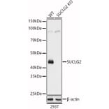 Western Blot - Anti-SUCLG2 Antibody (A90091) - Antibodies.com