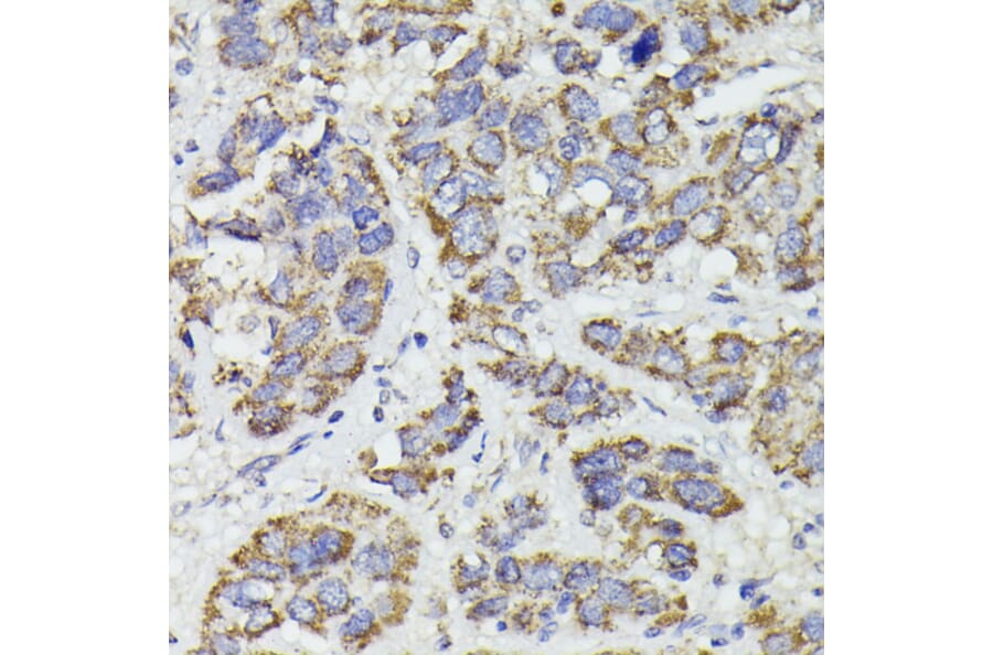 Immunohistochemistry - Anti-SUCLG2 Antibody (A90091) - Antibodies.com