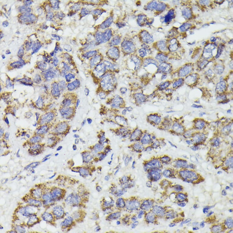 Immunohistochemistry - Anti-SUCLG2 Antibody (A90091) - Antibodies.com