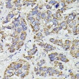Immunohistochemistry - Anti-SUCLG2 Antibody (A90091) - Antibodies.com