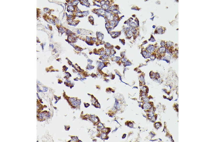 Immunohistochemistry - Anti-SUCLG2 Antibody (A90091) - Antibodies.com