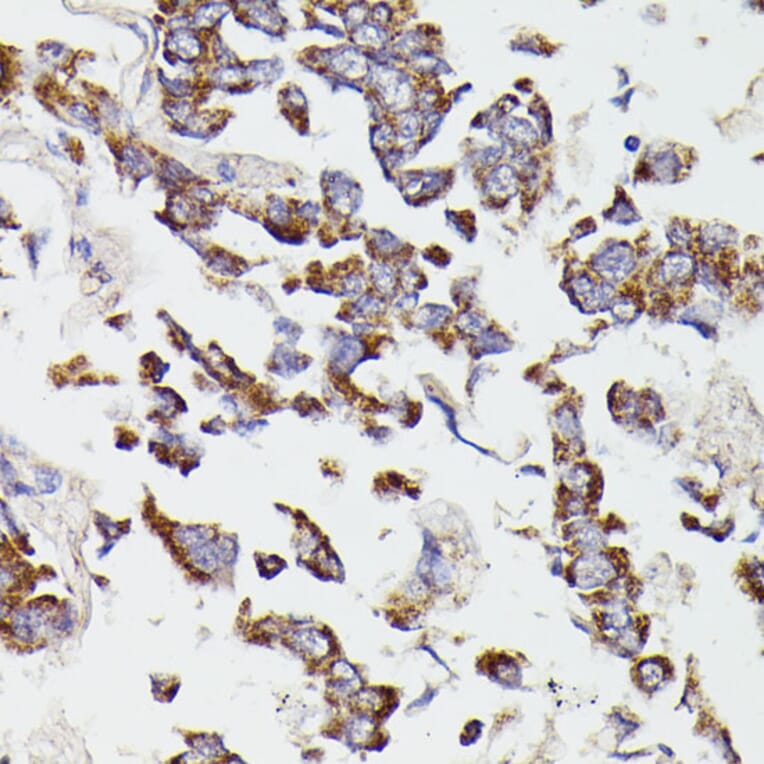 Immunohistochemistry - Anti-SUCLG2 Antibody (A90091) - Antibodies.com