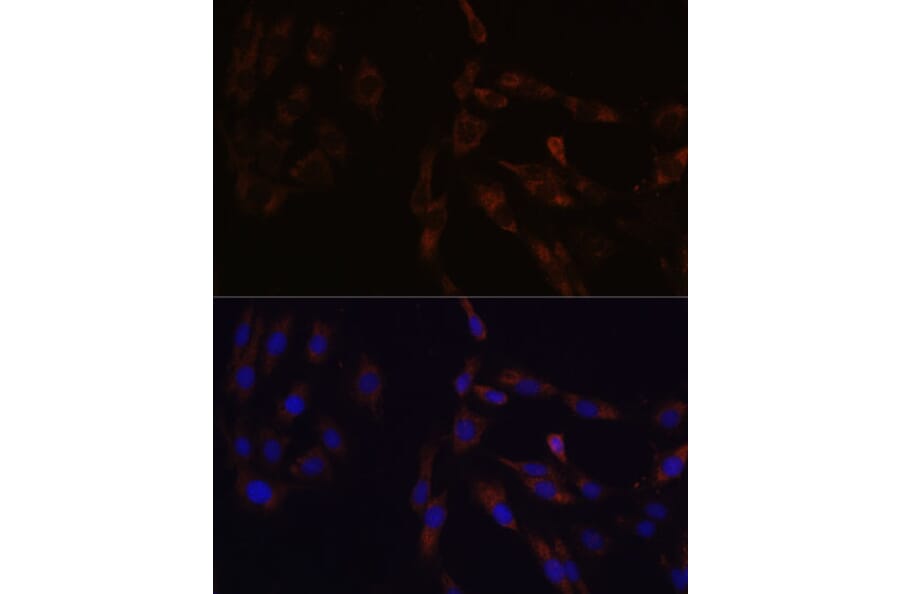 Immunofluorescence - Anti-SUCLG2 Antibody (A90091) - Antibodies.com