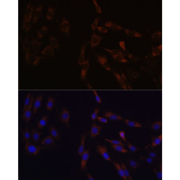 Immunofluorescence - Anti-SUCLG2 Antibody (A90091) - Antibodies.com