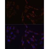 Immunofluorescence - Anti-SUCLG2 Antibody (A90091) - Antibodies.com