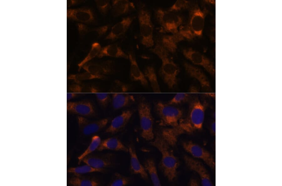 Immunofluorescence - Anti-SUCLG2 Antibody (A90091) - Antibodies.com