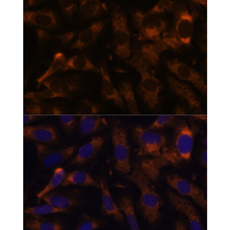 Immunofluorescence - Anti-SUCLG2 Antibody (A90091) - Antibodies.com