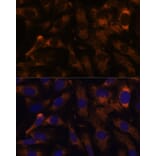 Immunofluorescence - Anti-SUCLG2 Antibody (A90091) - Antibodies.com
