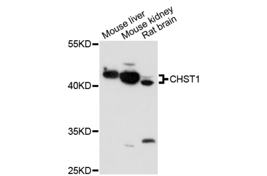 Western Blot - Anti-CHST1 Antibody (A13057) - Antibodies.com