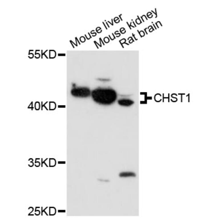 Western Blot - Anti-CHST1 Antibody (A13057) - Antibodies.com