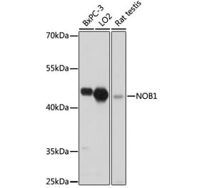 Western Blot - Anti-NOB1 Antibody (A90093) - Antibodies.com