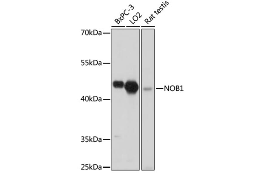 Western Blot - Anti-NOB1 Antibody (A90093) - Antibodies.com